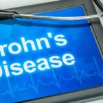 Managing Crohn’s Disease with Medical Marijuana